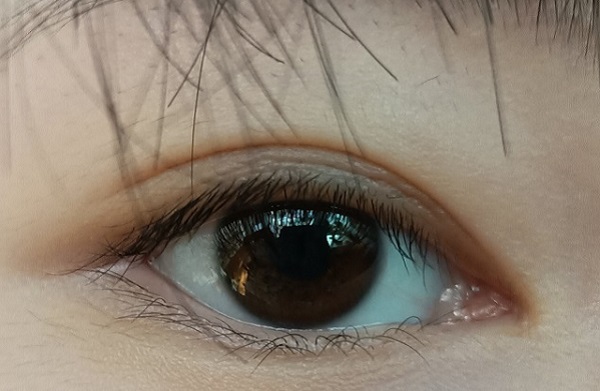 倒睫怎么辦？